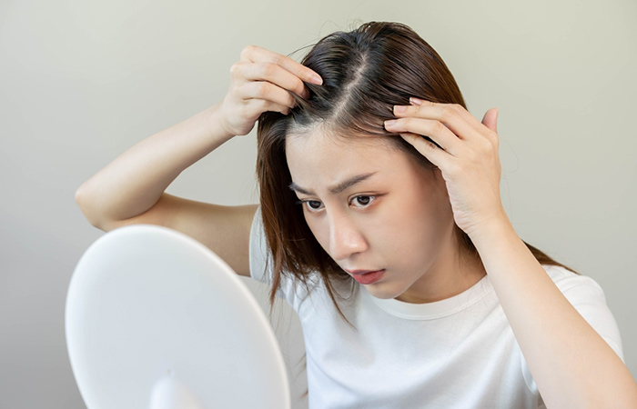 Woman looking at receding hairline to know the status of hair growth