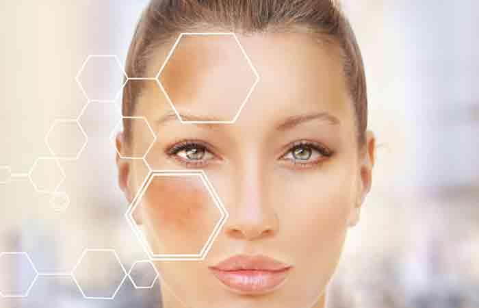 Kumquat may help suppress hyperpigmentation