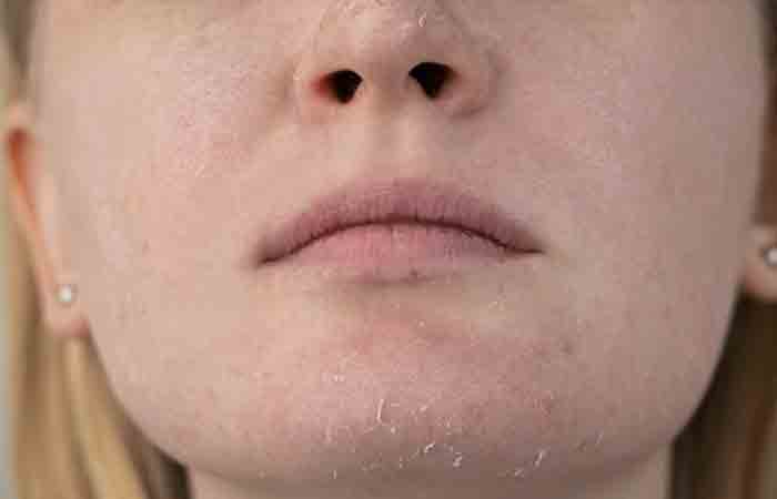 Woman examines dry skin on her face may benefit from tallow for skin care