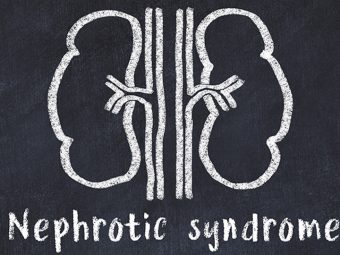 Nephrotic Syndrome in Hindi