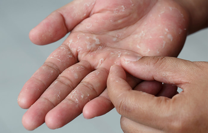 Woman peeling skin to remove nail glue
