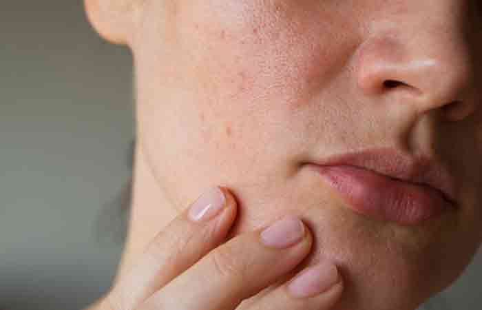 Woman with dry skin may benefit from astaxanthin