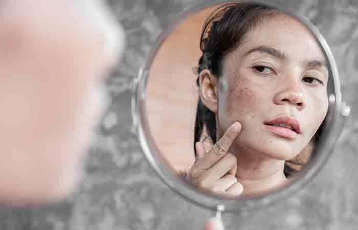 Woman checking hyperpigmentation on skin in the mirror