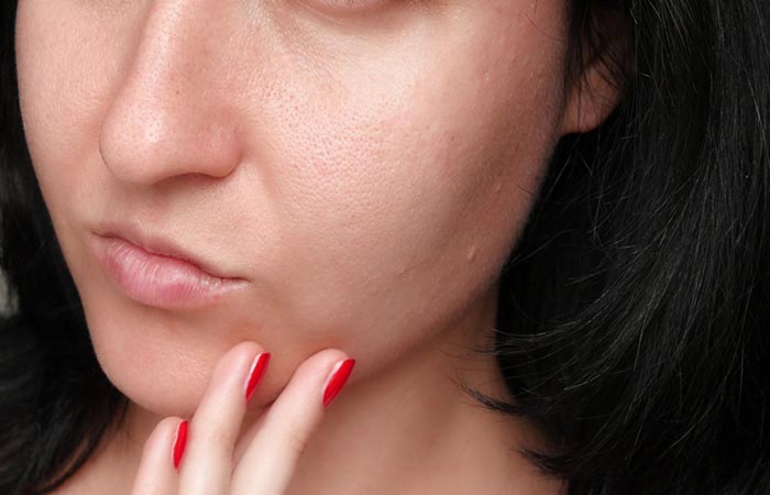 Woman with large pores may benefit from using face toner.