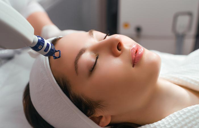 Laser treatment helps in improving the appearance of acne 