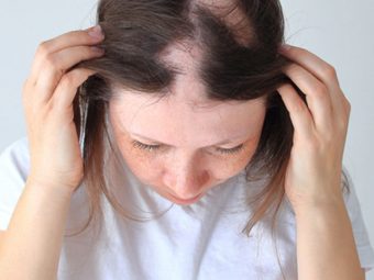 Восстановление и лечение волос при трихотилломании
