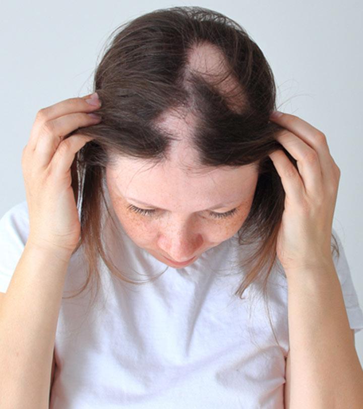 Trichotillomania Hair Regrowth And Treatment 