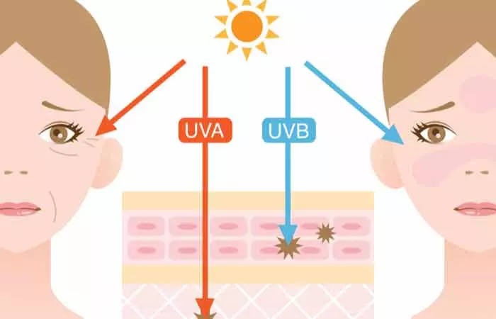 UV-Damage