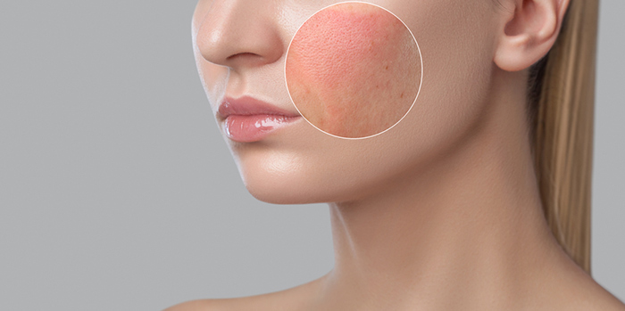 Dry brushing your face may cause skin irritation