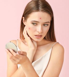 What Is Cephalexin? Can It Treat Acne?