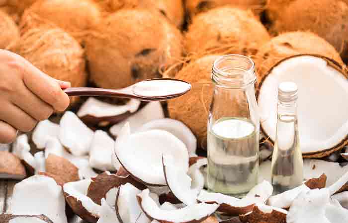 Virgin coconut oil for psoriasis