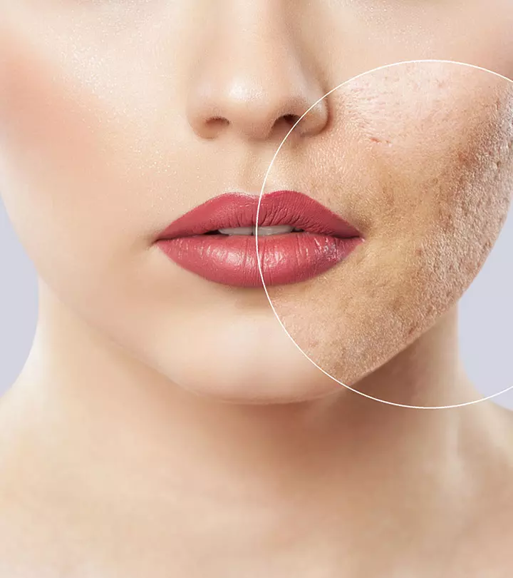 Woman using Brushing For Dry Face