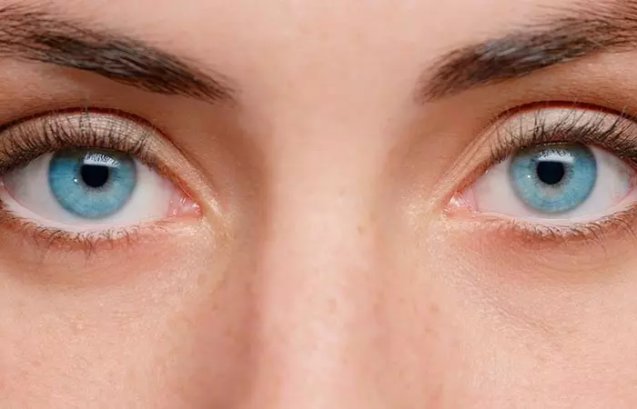 Under-eye fillers can reduce dark circles and brighten the eyes.