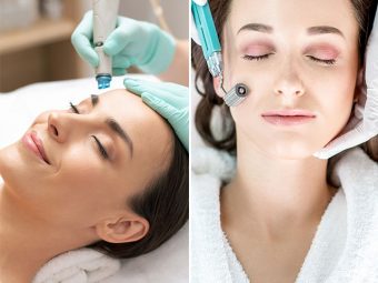 How Is Microneedling Different From Microdermabrasion