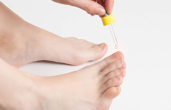 Woman applies tea tree oil on her toe nails