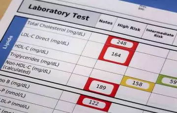 Cholesterol test result showing high bad cholesterol