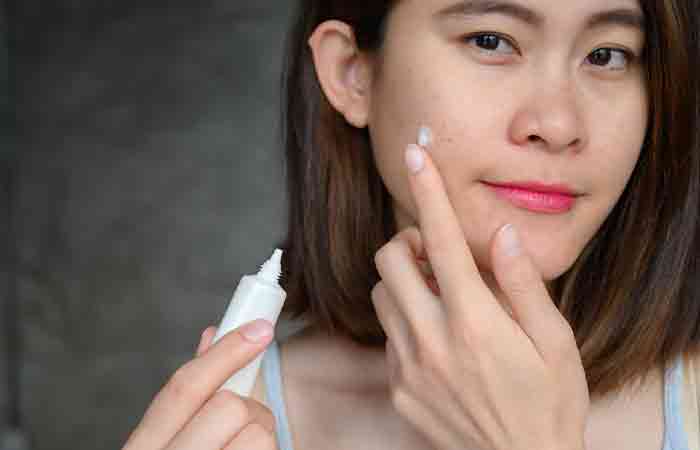 Woman applying acne cream formulated with hypochlorous acid