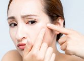How To Get Rid Of Scabs On Face