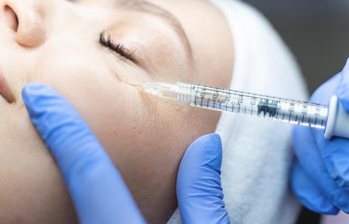 Woman gets under-eye fillers injected.