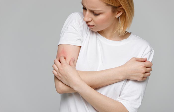 Woman scratching a red circular rash on her arm
