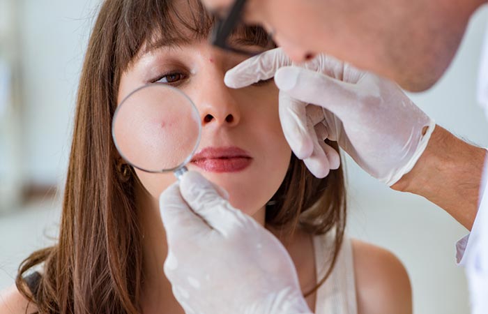 Dermatologist inspecting acne on the face of a woman