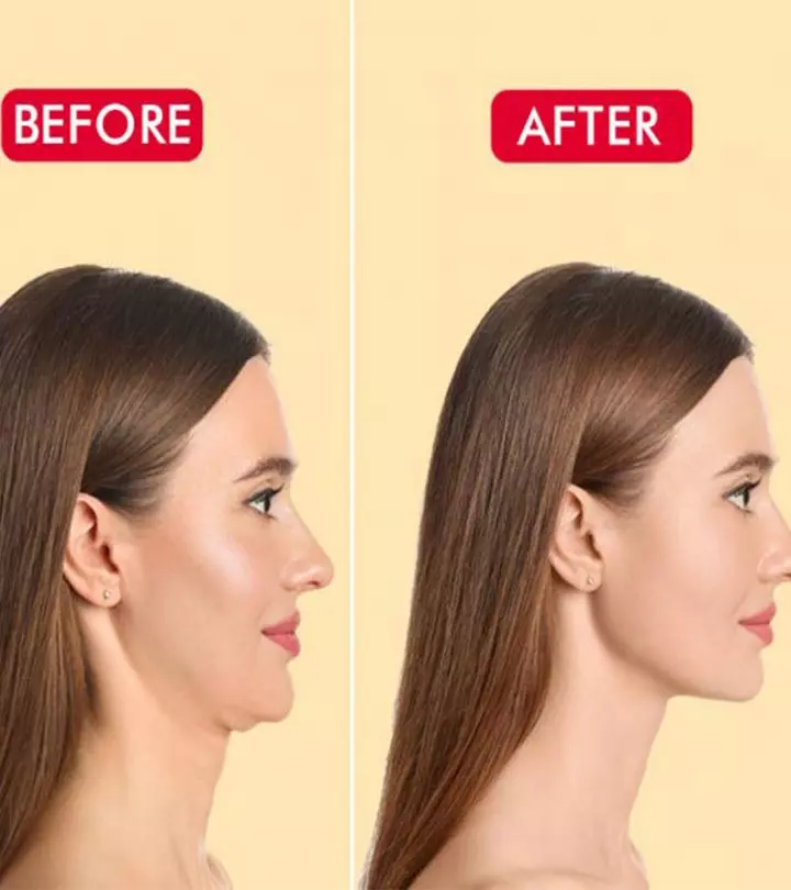 Saggy Neck? Do These 10 Neck Tightening Exercises At Home