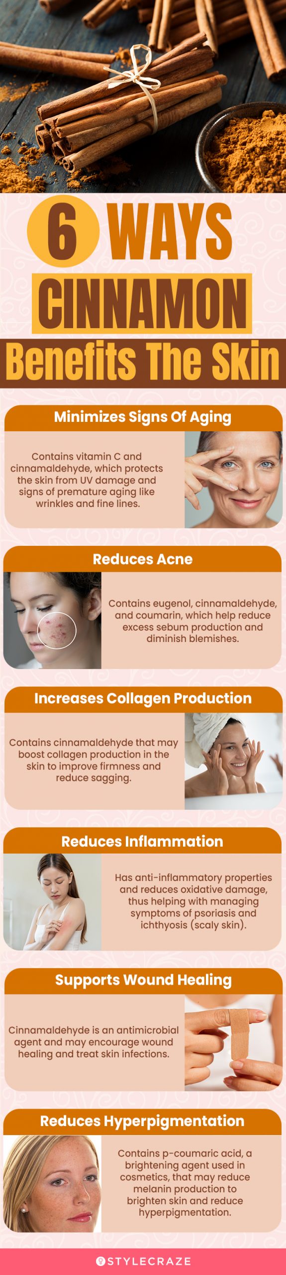 6 ways cinnamon benefits the skin (infographic)