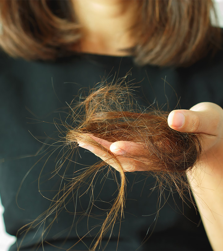 6 Ways To Prevent Seasonal Hair Fall
