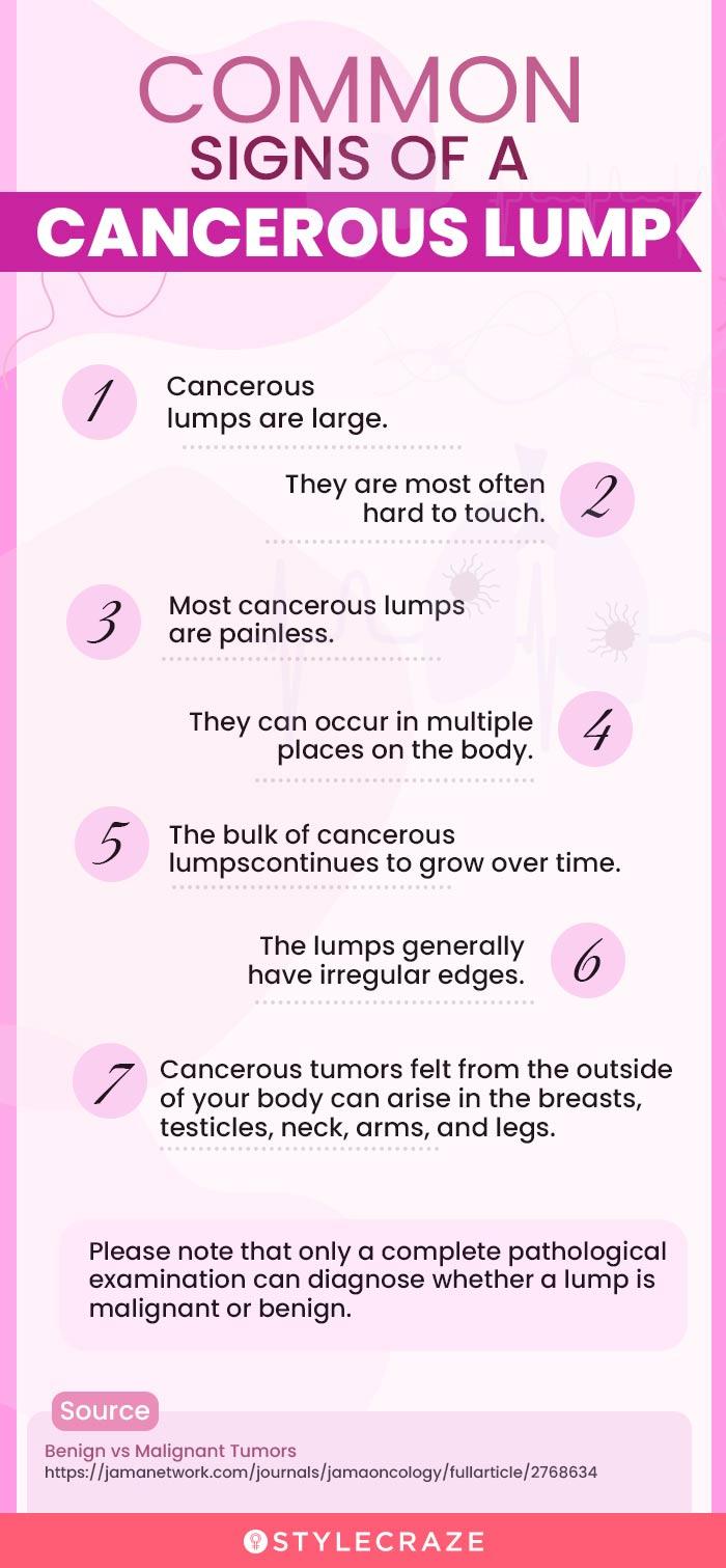 common sighs of a cancerous lump (infographic)