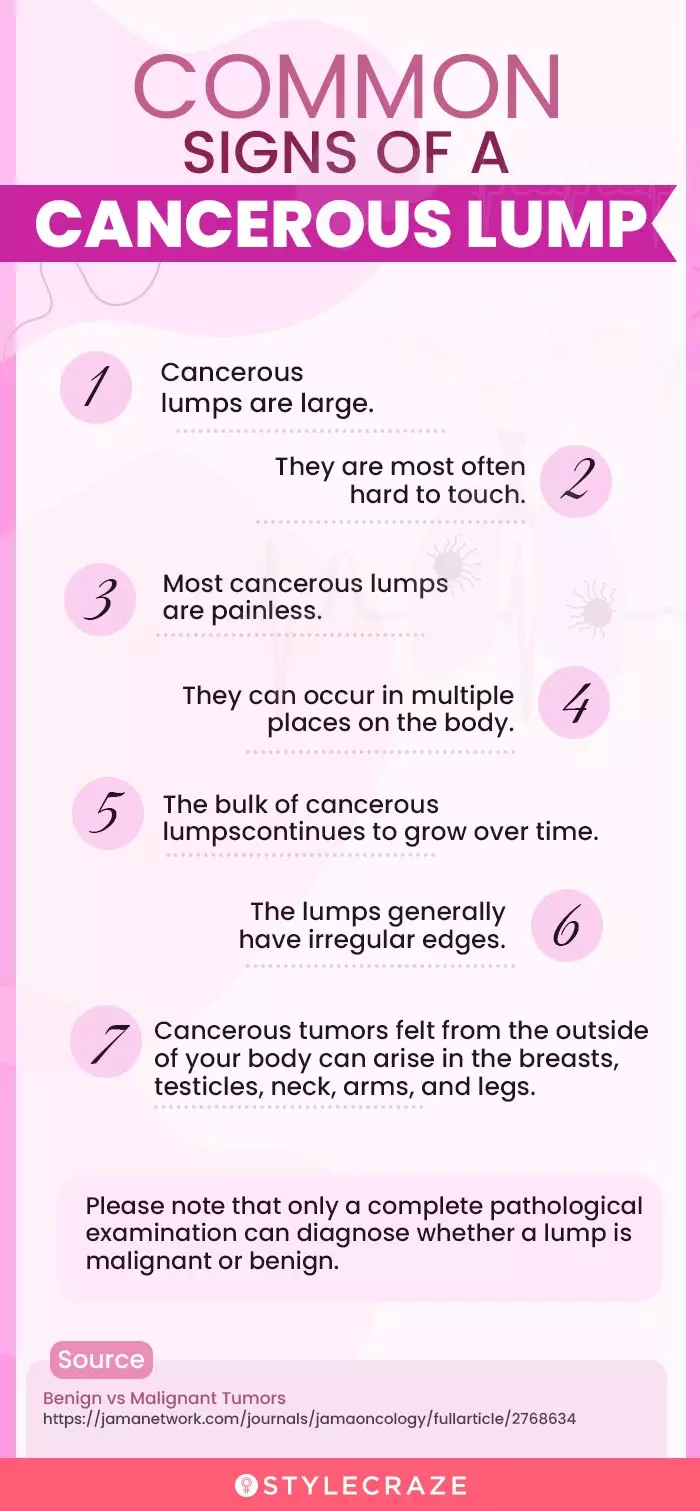 common sighs of a cancerous lump (infographic)