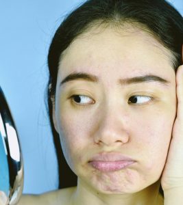 Congested Skin: Symptoms, Causes, Home Remedies, And More