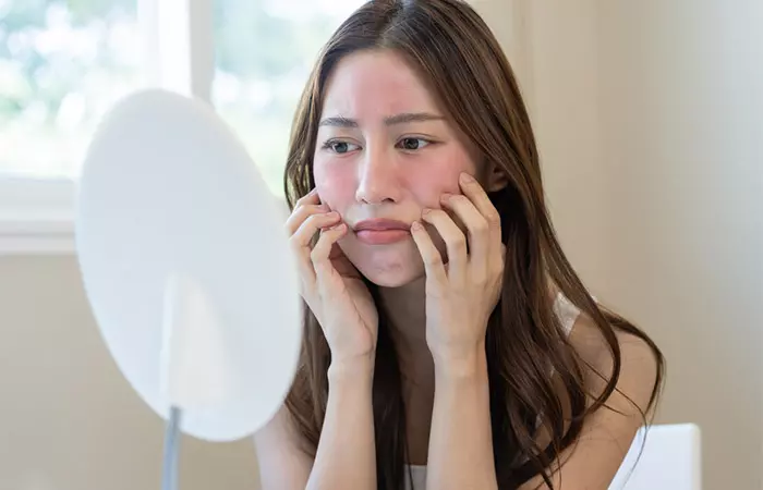 Woman looking at skin irritation for juniper berries