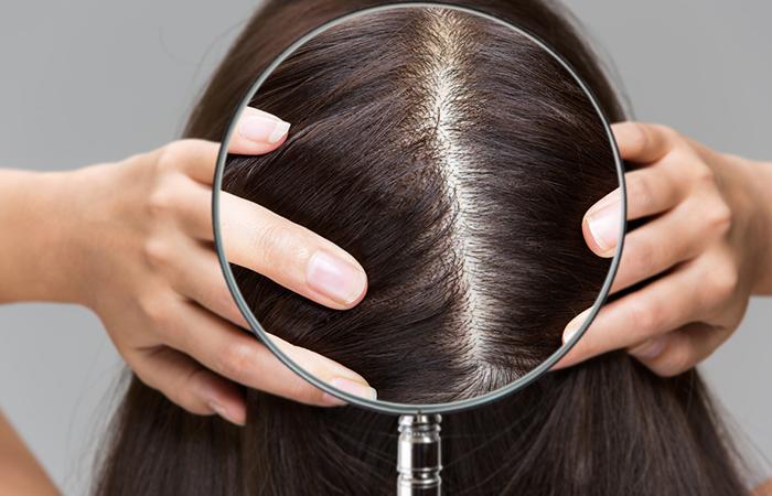 Minimizes-Scalp-Impurities