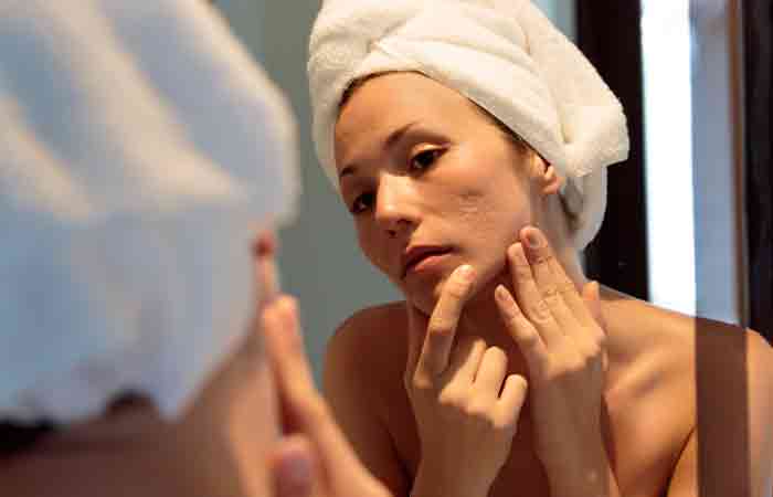 Woman looking at her pitted acne scars in the mirror
