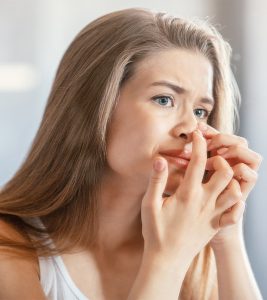 What Are Sebaceous Filaments? How To Get Rid Of Them?