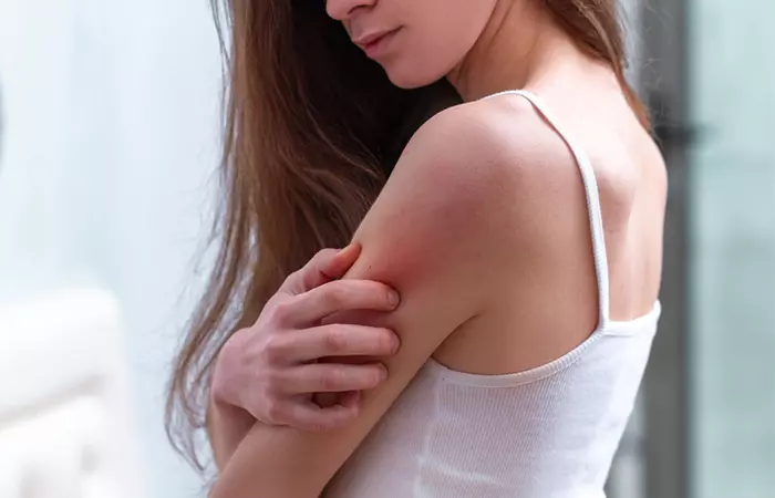 Woman scratching her arm due to skin infection