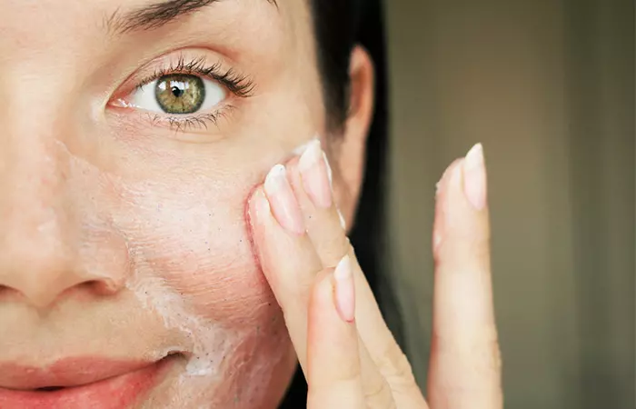 Woman with sensitive skin applying retinaldehyde for relief