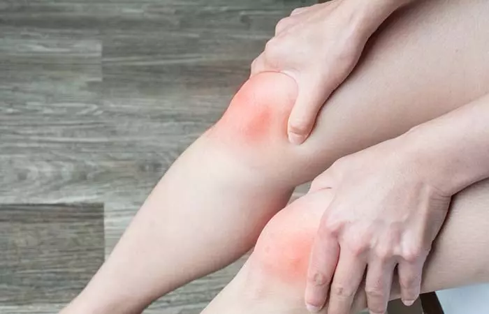 3.-Muscle-Instability