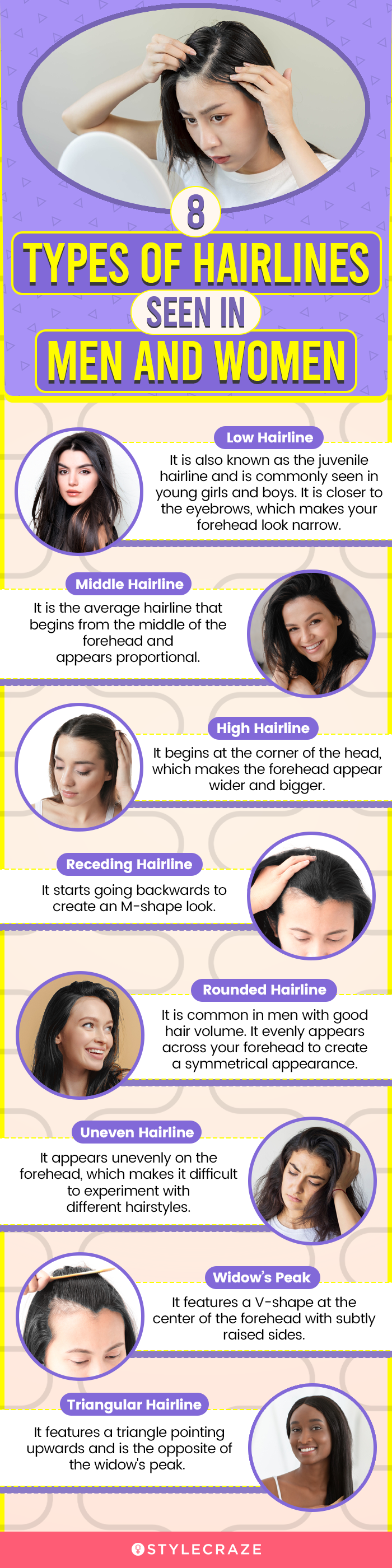 8 types of hairlines seen in men and women (infographic)