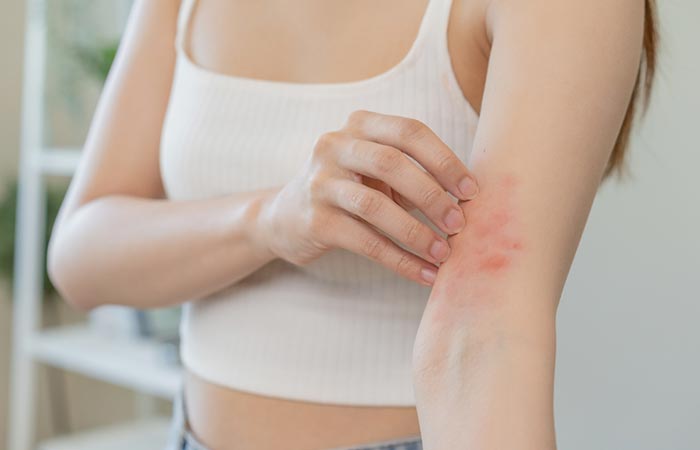Aquagenic pruritus might cause itchy skin after a bath