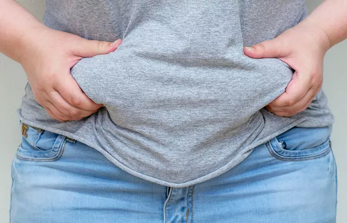 Close-up of a woman with obesity