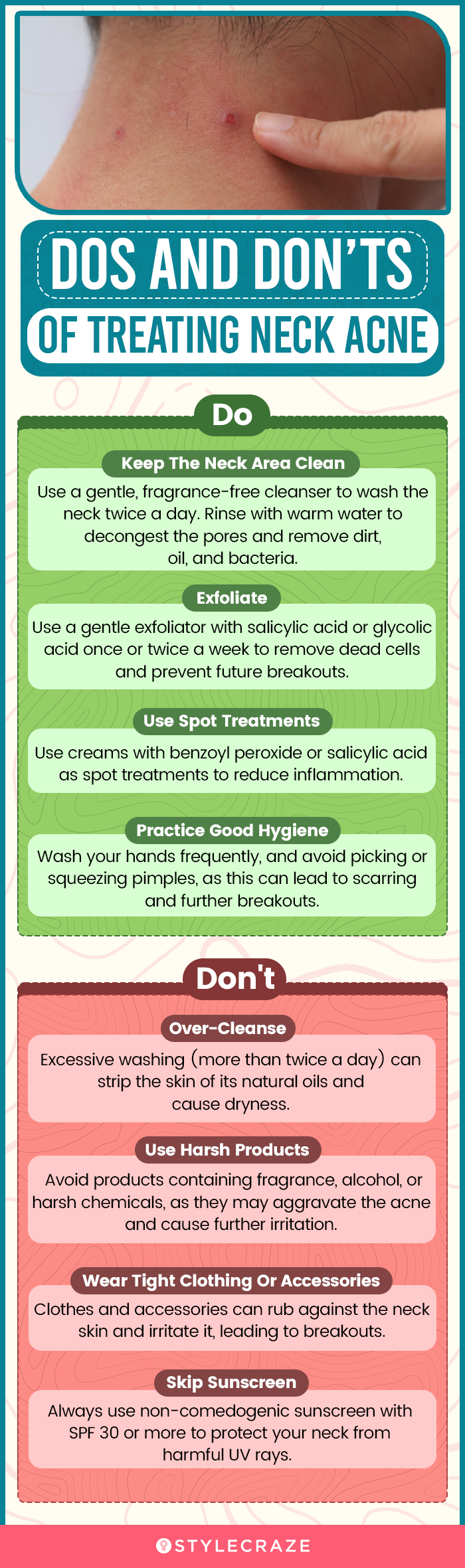 dos and don’ts of treating neck acne (infographic)