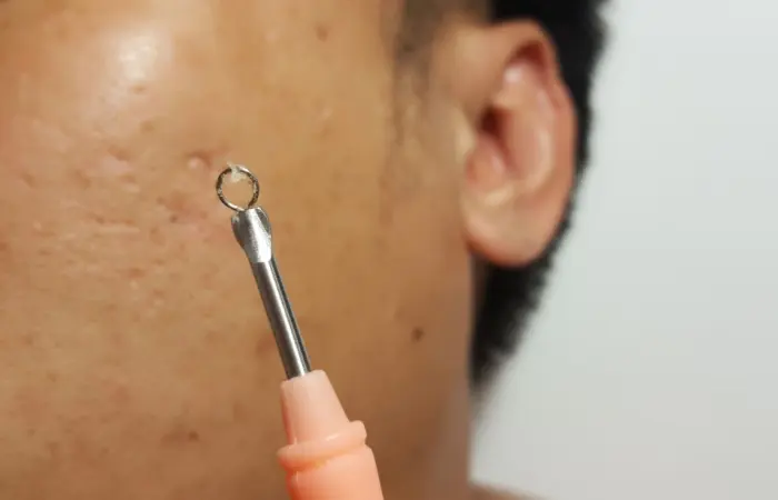 a blackhead extraction tool