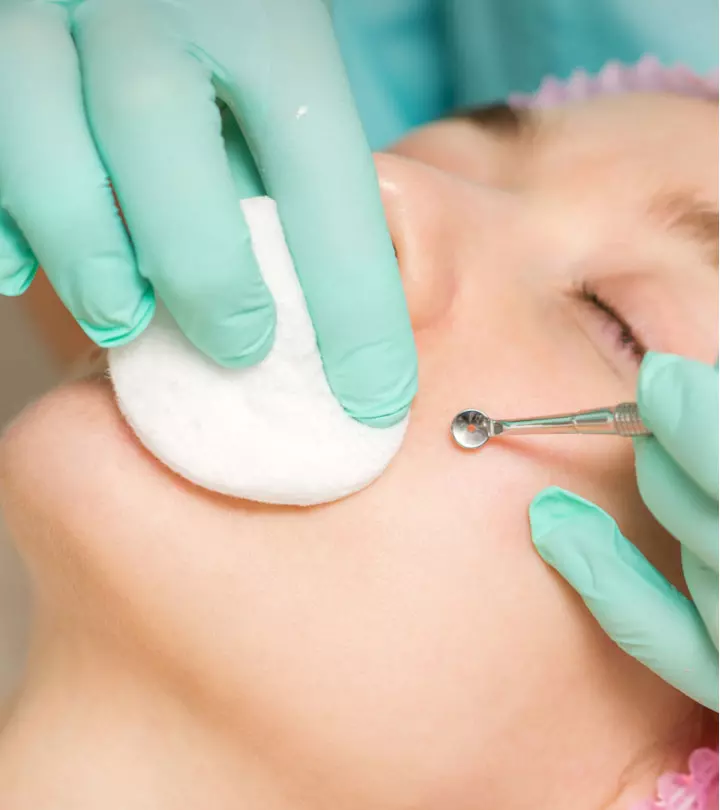 A girl showing her sebaceous filaments