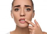 White Bumps On Lips: Types, Causes, Symptoms, & Home Remedies
