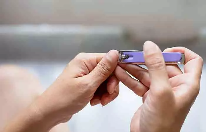 Woman trimming her nails to prevent scratching