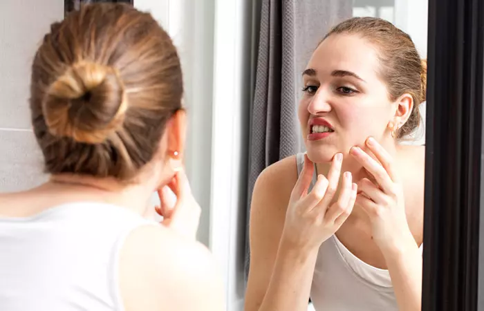 Woman takes precautions to avoid perioral dermatitis.