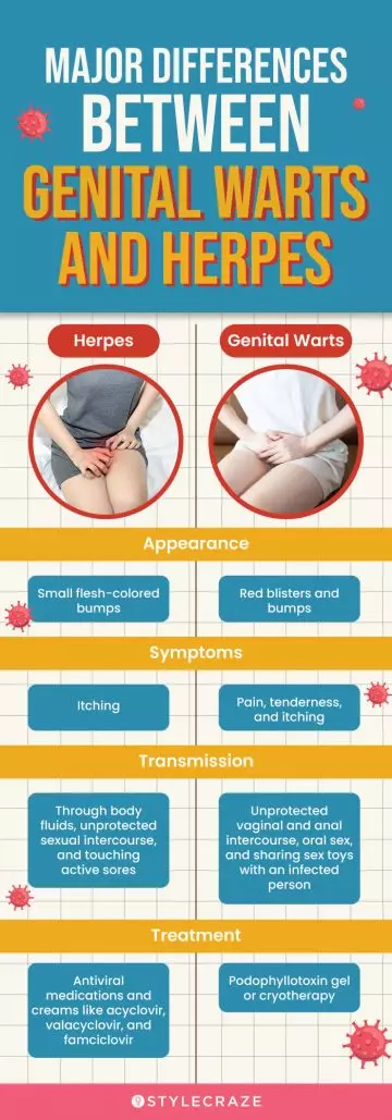 major differences between genital warts and herpes (infographic)