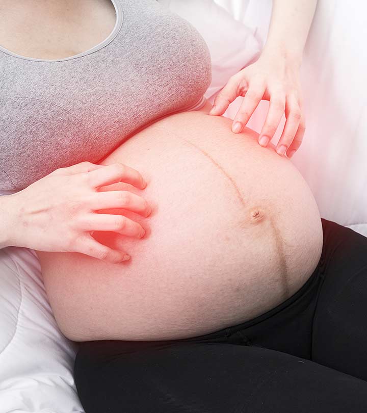 7 Types Of Pregnancy Rash, Causes, Home Remedies, & Treatment