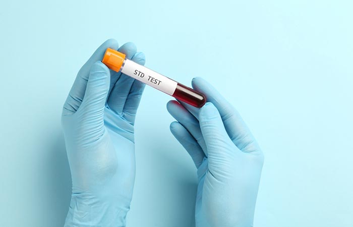 Doctor holding blood sample for STD test